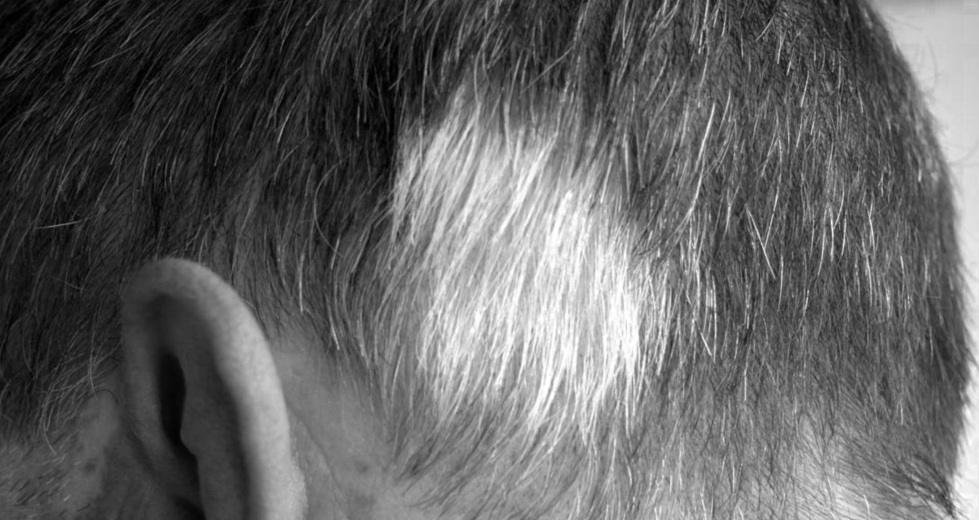 Hair Care Tips In Hindi: कम उम्र में हो रहे हैं बाल सफेद, तो जान लीजिए इसकी  वजह, बरतें सावधानी - lifestyle