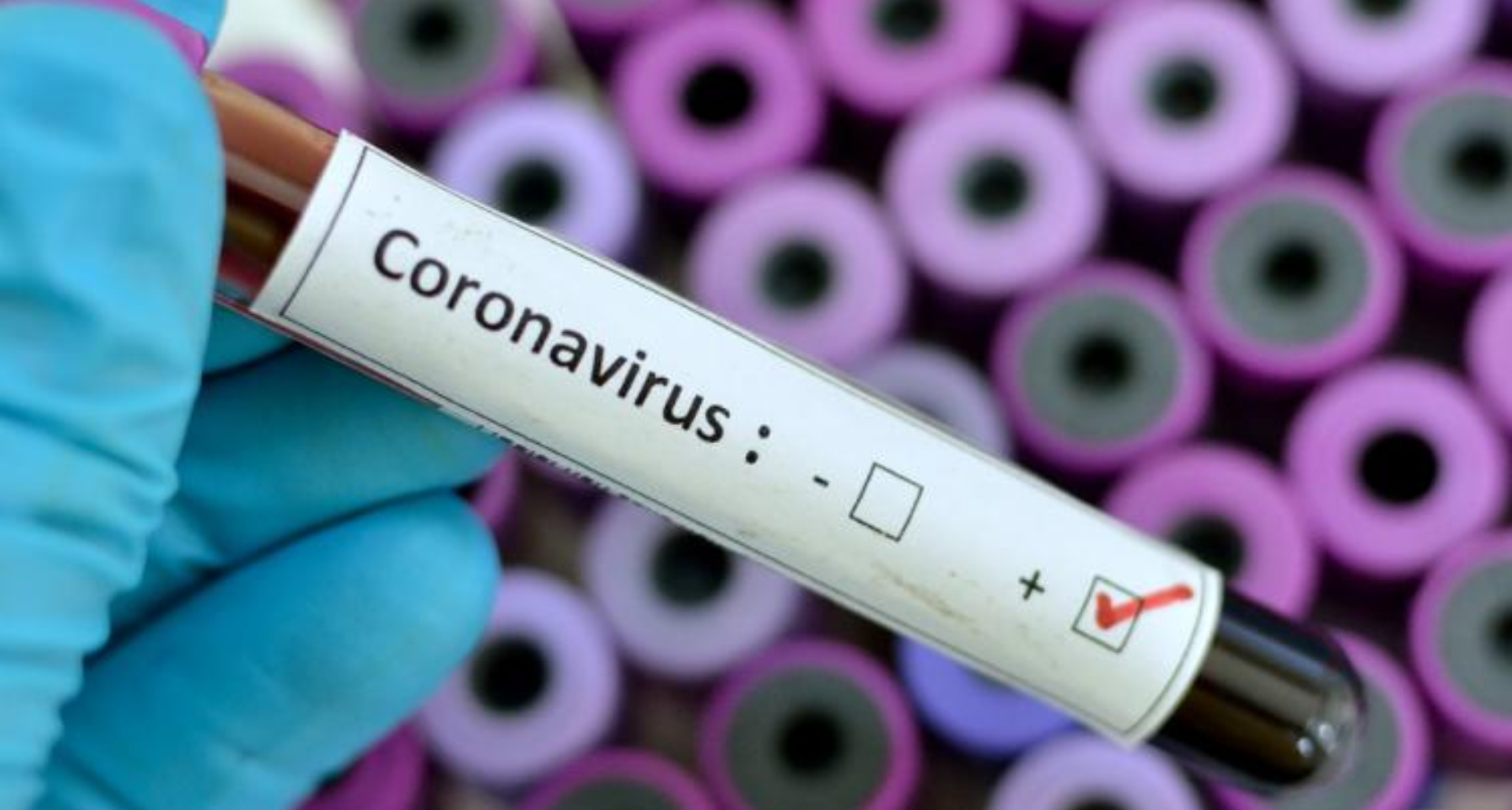 Coronavirus In Gujarat: कोरोना के वजह से 14 महीने की बच्ची की हुई मौत, आकड़ा पहुंचा 16 पर