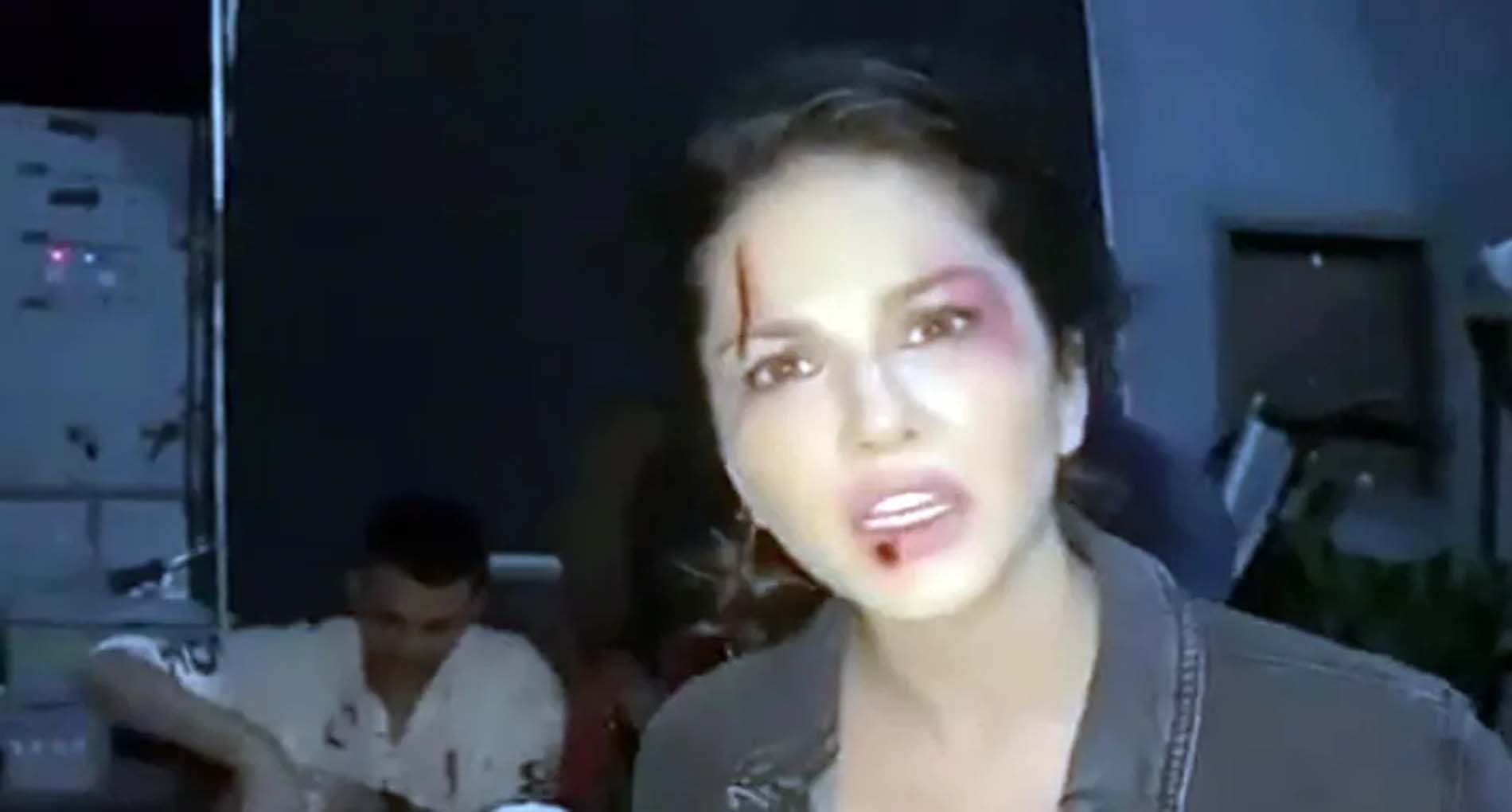Sunny Leone Video: सनी लियोन के चेहरे पर चोट के निशान! वीडियो वायरल