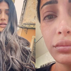 Shruti Haasan shared pictures of swollen face and disheveled hair